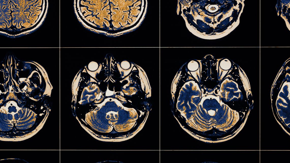 MRI Image of Human Brain Close-up